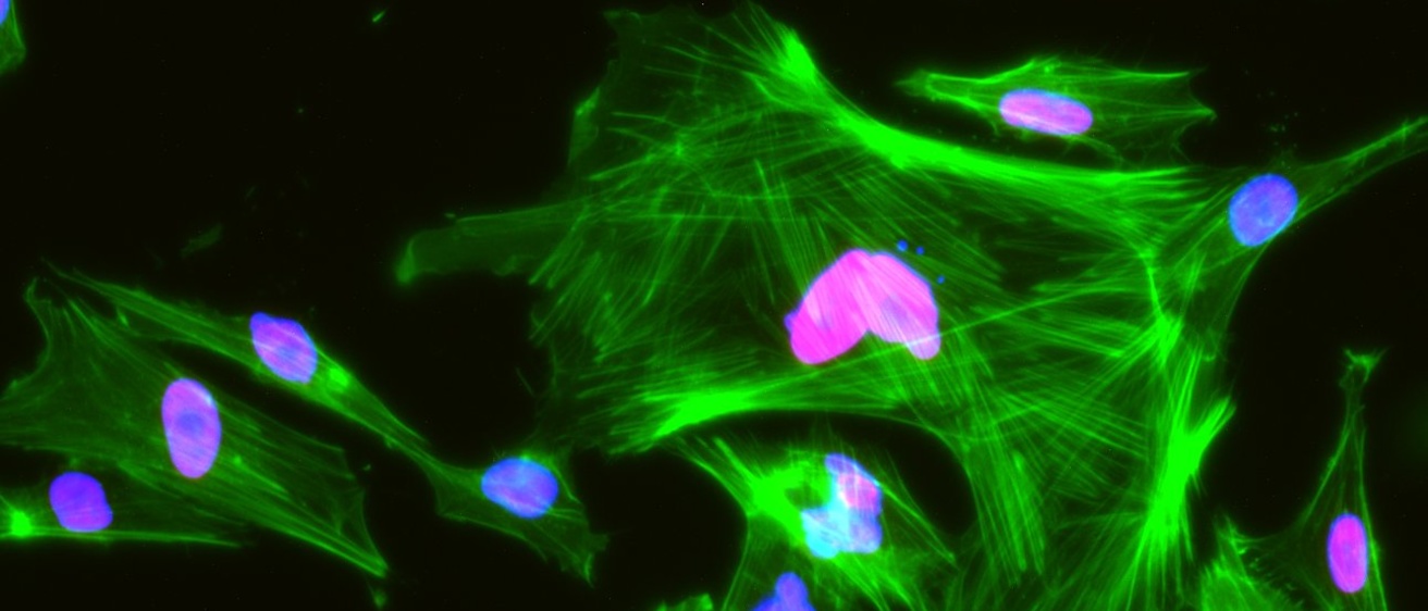 Cell nucleus staining