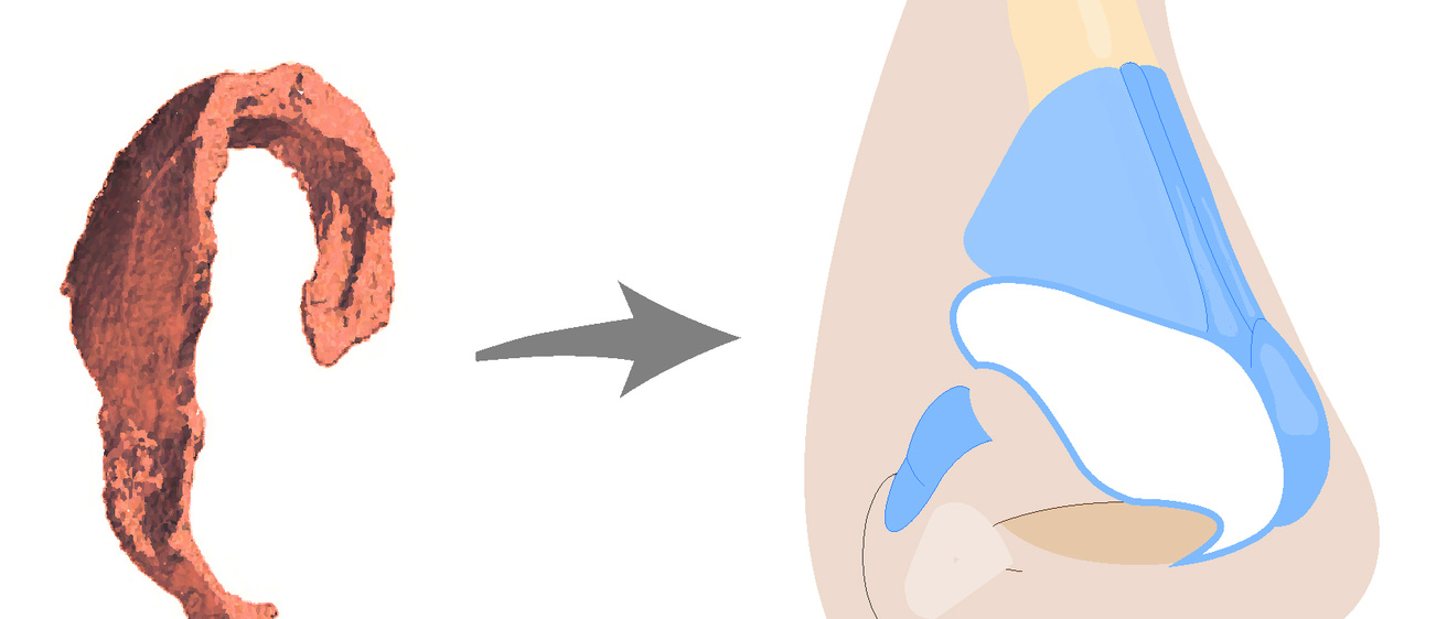 Nasal Cartilage regeneration