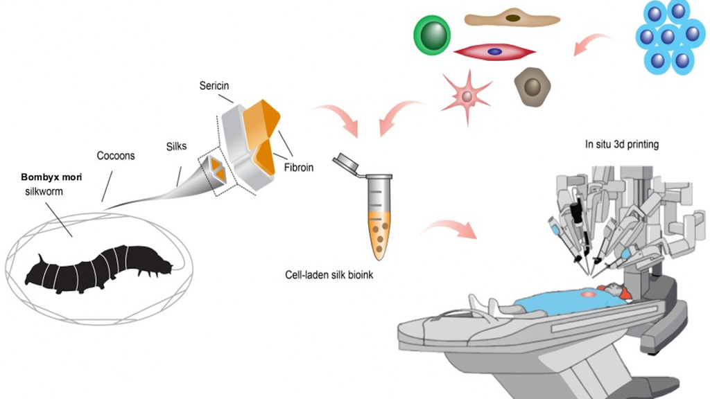 In vivo 3D printing