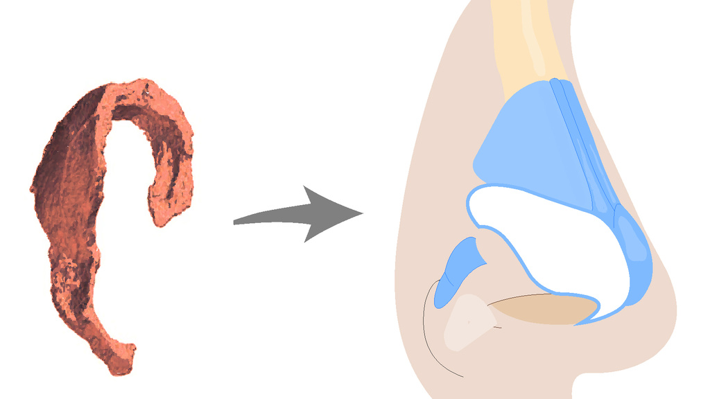Nasal Cartilage regeneration
